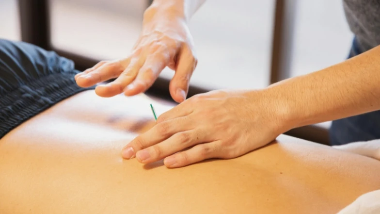 What Actually Happens Inside Your Body During Dry Needling